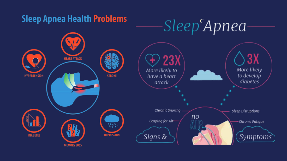 Night Watch: How Mouth Tape Can Transform Sleep for Apnea Sufferers